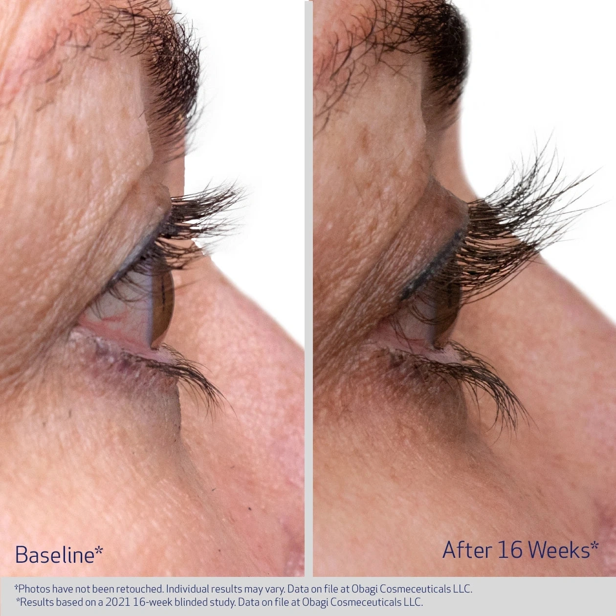 OBAGI® NU-CIL® Eyelash Enhancing Serum / OBAGI