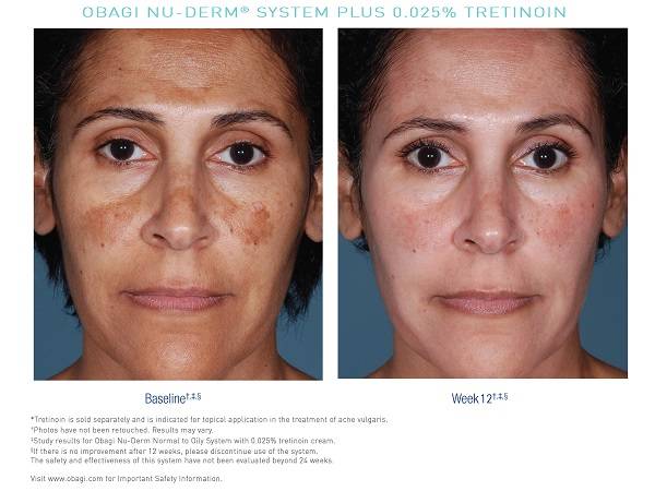 Догляд за шкірою Obagi Nu-Derm
