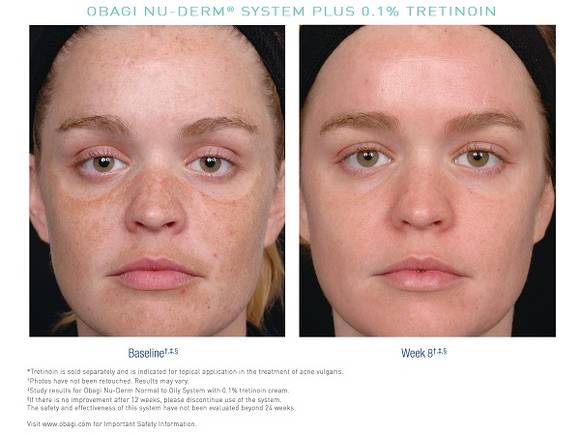 Догляд за шкірою Obagi Nu-Derm