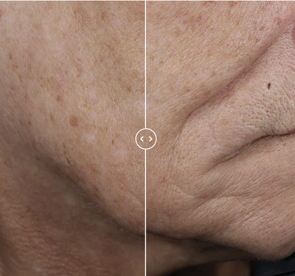 Lift Up & Sculpt Facial Moisturizer