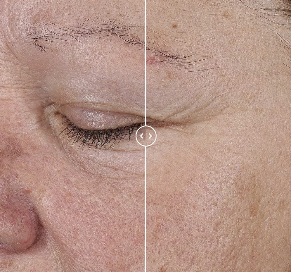 Lift Up & Sculpt Facial Moisturizer