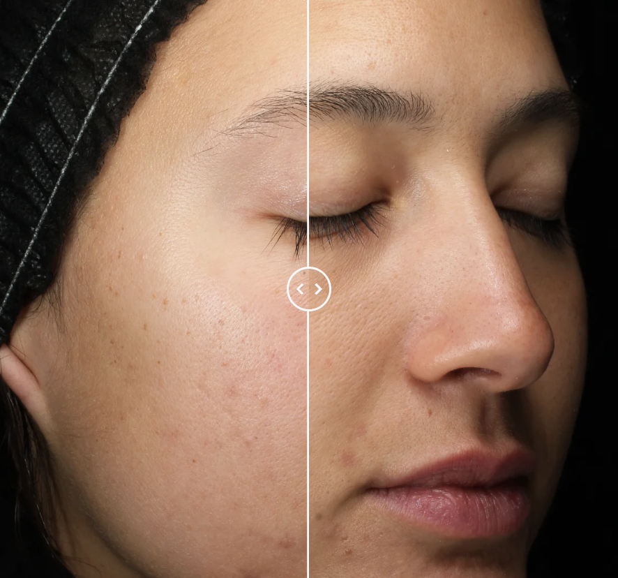 Obagi Retinol+PHA